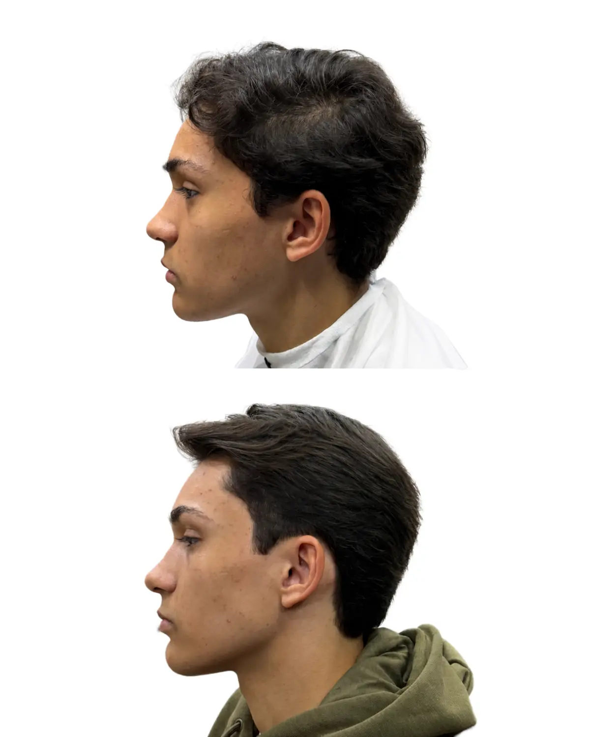 Comparação do cabelo antes e depois do corte